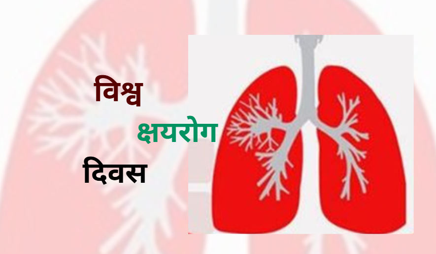 आज विश्व क्षयरोग दिवस मनाइँदै